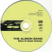 CD - The Albion Band - Before Us Stands Yesterday