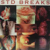 The Wax Fondler - STD Breaks