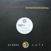 Ultra Deep