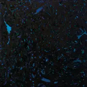 Double LP - Zenker Brothers - Immersion