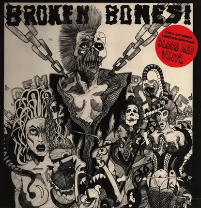 Broken Bones - Dem Bones