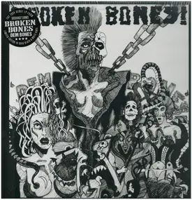 broken bones - Dem Bones