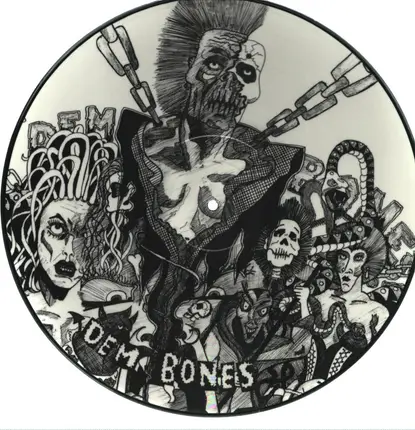 Broken Bones - Dem Bones
