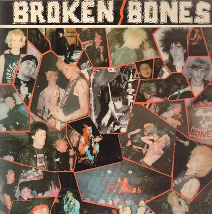 Broken Bones - Never Say Die