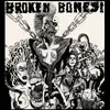 LP - Broken Bones! - Dem Bones