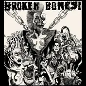 broken bones
