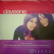 DaYeene - And It Hurts