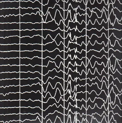 DJ Matuss - Seizure No. 5
