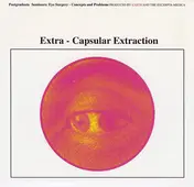 Earth - Extra-Capsular Extraction
