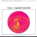 Earth - Extra-Capsular Extraction