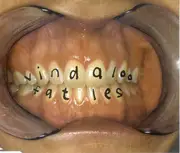 CD Single - Fat Les - Vindaloo