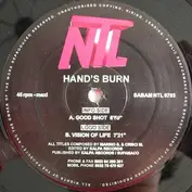 Hands Burn