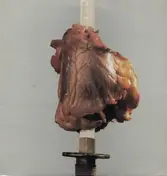 Gore - Hart Gore