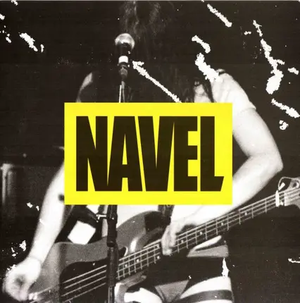 Navel - Vomiting