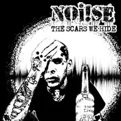 NOI!SE - The Scars We Hide