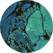 PRIS - Unbeknown