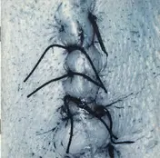 Scheer - Infliction
